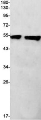 Western Blot: Annexin A7 Antibody (S07-1D2) [NBP3-19944] - Western blot detection of Annexin A7 in K562 (Lane 1), Rat Brain (Lane 2) cell lysates using NBP3-19944 (1:1000 diluted). Predicted band size: 53kDa. Observed band size: 53kDa.