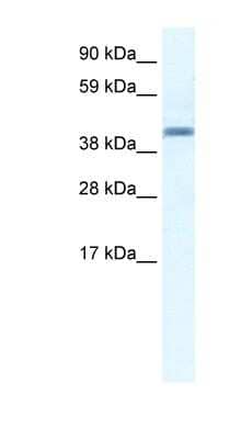 Western Blot: Annexin A7 Antibody [NBP1-59099] - Human Placenta lysate, concentration 2.5 ug/ml.