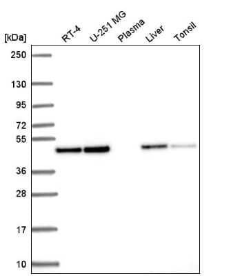 Western Blot: Annexin A7 Antibody [NBP2-57620] - Western blot analysis in human cell line RT-4, human cell line U-251 MG, human plasma, human liver tissue and human tonsil tissue.