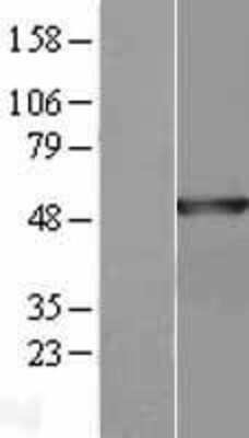 Western Blot: Annexin A7 Overexpression Lysate (Adult Normal) [NBL1-07567] Left-Empty vector transfected control cell lysate (HEK293 cell lysate); Right -Over-expression Lysate for Annexin A7.