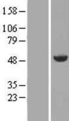 Western Blot: Annexin A7 Overexpression Lysate (Adult Normal) [NBP2-10558] Left-Empty vector transfected control cell lysate (HEK293 cell lysate); Right -Over-expression Lysate for Annexin A7.