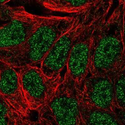 Immunocytochemistry/Immunofluorescence: Annexin A8/ANXA8 Antibody [NBP2-57118] - Staining of human cell line RT4 shows localization to nucleoplasm.