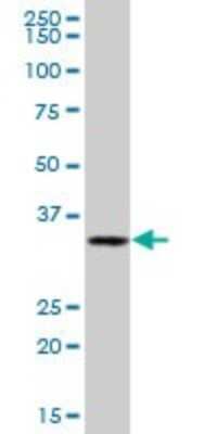 Western Blot: Annexin A8/ANXA8 Antibody [H00653145-B01P] - Analysis of ANXA8 expression in human pancreas.