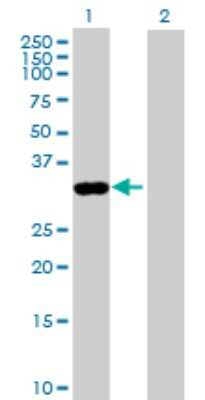 Western Blot: Annexin A8/ANXA8 Antibody [H00653145-B01P] - Analysis of ANXA8 expression in transfected 293T cell line by ANXA8 polyclonal antibody.  Lane 1: ANXA8 transfected lysate(35.97 KDa). Lane 2: Non-transfected lysate.