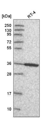 Western Blot: Annexin A8/ANXA8 Antibody [NBP2-57118] - Western blot analysis in human cell line RT-4.
