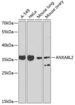 Western Blot: Annexin A8/ANXA8 Antibody [NBP3-05654] - Analysis of extracts of various cell lines, using Annexin A8/ANXA8 antibody (NBP3-05654) at 1:1000 dilution. Secondary antibody: HRP Goat Anti-Rabbit IgG (H+L) at 1:10000 dilution. Lysates/proteins: 25ug per lane. Blocking buffer: 3% nonfat dry milk in TBST. Detection: ECL Basic Kit. Exposure time: 90s.