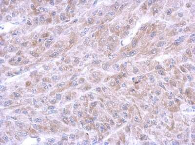 Immunohistochemistry-Paraffin: Annexin A8/ANXA8 Antibody [NBP2-15410] - U87 xenograft, using Annexin A11 antibody at 1:500 dilution. Antigen Retrieval: Trilogy™ (EDTA based, pH 8.0) buffer, 15min.
