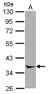 Western Blot: Annexin A8/ANXA8 Antibody [NBP2-15410] - Sample (30 ug of whole cell lysate) A: A549 10% SDS PAGE; antibody diluted at 1:1000.