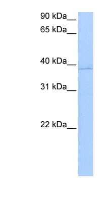 Western Blot: Annexin A8 like2 Antibody [NBP1-59128] - Titration: 0.2-1 ug/ml, Positive Control: MCF7 cell lysate.