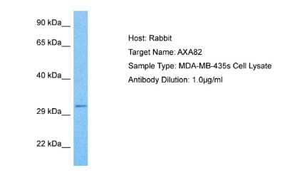 Western Blot: Annexin A8 like2 Antibody [NBP2-86576] - Host: Rabbit. Target Name: AXA82. Sample Tissue: MDA-MB-435s Whole cell lysates. Antibody Dilution: 1.0ug/ml
