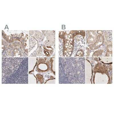 Immunohistochemistry-Paraffin: Annexin A9 Antibody [NBP1-90152] - Staining of human colon, kidney, lymph node and thyroid gland using Anti-ANXA9 antibody NBP1-90152 (A) shows similar protein distribution across tissues to independent antibody NBP1-90153 (B).