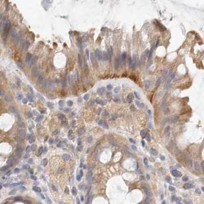 Immunohistochemistry-Paraffin: Annexin A9 Antibody [NBP1-90152] - Staining of human colon.