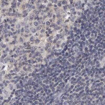 Immunohistochemistry-Paraffin: Annexin A9 Antibody [NBP1-90152] - Staining of human lymph node.