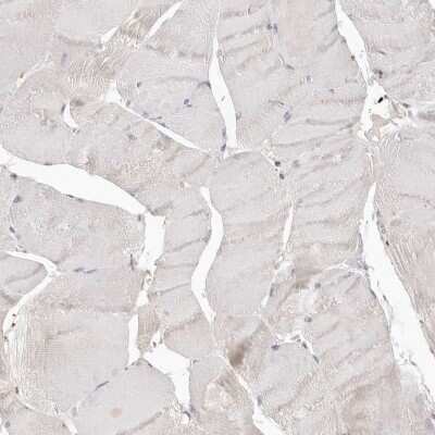 Immunohistochemistry-Paraffin: Annexin A9 Antibody [NBP1-90153] - Staining of human skeletal muscle shows low expression as expected.