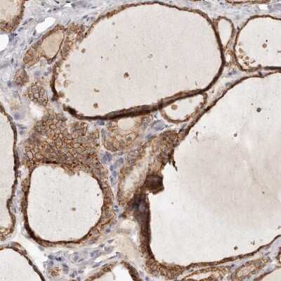 Immunohistochemistry-Paraffin: Annexin A9 Antibody [NBP1-90153] - Staining of human thyroid gland shows high expression.