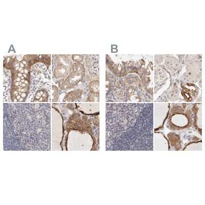 Immunohistochemistry-Paraffin: Annexin A9 Antibody [NBP1-90153] - Staining of human colon, kidney, lymph node and thyroid gland using Anti-ANXA9 antibody NBP1-90153 (A) shows similar protein distribution across tissues to independent antibody NBP1-90152 (B).