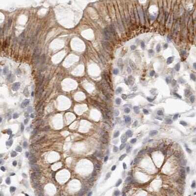 Immunohistochemistry-Paraffin: Annexin A9 Antibody [NBP1-90153] - Staining of human colon.