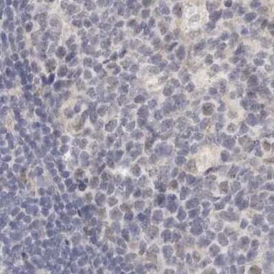 Immunohistochemistry-Paraffin: Annexin A9 Antibody [NBP1-90153] - Staining of human lymph node.
