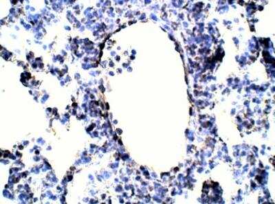 Immunohistochemistry-Paraffin: Annexin A9 Antibody [NBP3-12451] - 1:50 dilution in IHC blocking buffer. DAB (brown) staining in Hematoxlin QS (blue) counterstain. 40X magnification.