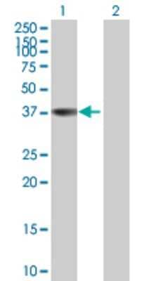 Western Blot: Annexin A9 Antibody [H00008416-B01P] - Analysis of ANXA9 expression in transfected 293T cell line by ANXA9 polyclonal antibody.  Lane 1: ANXA9 transfected lysate(37.18 KDa). Lane 2: Non-transfected lysate.