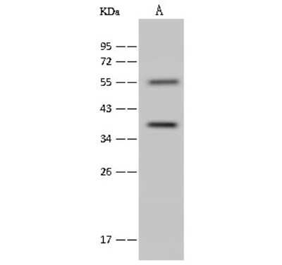 Western Blot: Annexin A9 Antibody [NBP2-99556] - Anti-Annexin A9 rabbit polyclonal antibody at 1:500 dilution. Lane A: A431 Whole Cell Lysate. Lysates/proteins at 30 ug per lane. Secondary Goat Anti-Rabbit IgG (H+L)/HRP at 1/10000 dilution. Developed using the ECL technique. Performed under reducing conditions. Predicted band size: 36 kDa. Observed band size: 36 kDa