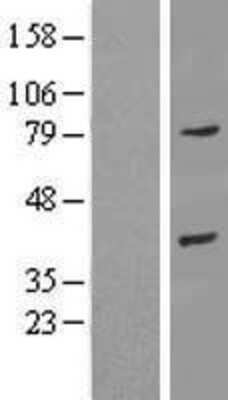 Western Blot: Annexin A9 Overexpression Lysate (Adult Normal) [NBL1-07568] Left-Empty vector transfected control cell lysate (HEK293 cell lysate); Right -Over-expression Lysate for Annexin A9.