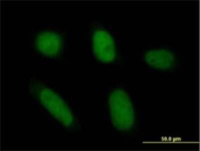 Immunocytochemistry/Immunofluorescence: Annexin V Antibody [H00000308-B01P] - Analysis of purified antibody to ANXA5 on HeLa cell. (antibody concentration 10 ug/ml)