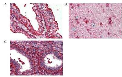 Immunohistochemistry-Paraffin: Annexin V Antibody [NB100-1930] - A) Prostate, B) Brain cortex and C) Uterus tissue. FFPE tissue after heat-induced antigen retrieval. 2.5 ug/mL of antibody used for staining. After incubation with the primary antibody, slides were incubated with biotinylated secondary antibody, followed by alkaline phosphatase-streptavidin and chromogen.