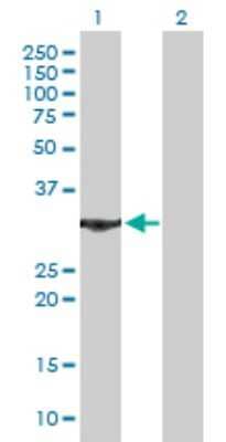 Western Blot: Annexin V Antibody [H00000308-B01P] - Analysis of ANXA5 expression in transfected 293T cell line by ANXA5 polyclonal antibody.  Lane 1: ANXA5 transfected lysate(35.2 KDa). Lane 2: Non-transfected lysate.