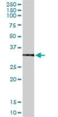 Western Blot: Annexin V Antibody [H00000308-D01P] - Analysis of ANXA5 expression in human liver.