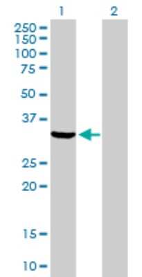 Western Blot: Annexin V Antibody [H00000308-D01P] - Analysis of ANXA5 expression in transfected 293T cell line by ANXA5 polyclonal antibody.Lane 1: ANXA5 transfected lysate(35.90 KDa).Lane 2: Non-transfected lysate.