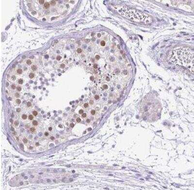 Immunohistochemistry-Paraffin: Anoctamin 4 Antibody [NBP2-30727] - Staining of human testis shows moderate nuclear positivity in cells in seminiferus ducts.