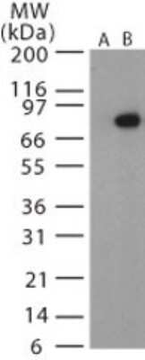 Western Blot: Anthrax PA Antibody - Azide Free [NB100-55743] - Analysis of Anthrax PA in recombinant protein using this antibody (Lane B) at 1:1000 dilution. Lane A shows the pre-bleed.