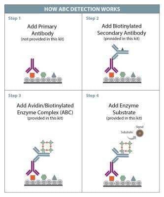 Immunohistochemistry: Anti-Rabbit HRP-AEC IHC Detection Kit [CTS006-NOV]