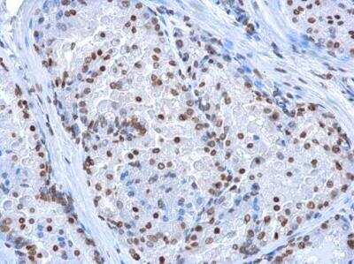 Immunohistochemistry-Paraffin: Antibody (GT13612) - Detection of protein at nucleus on mouse prostate. Dilution: 1:100