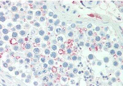 Immunohistochemistry-Paraffin ADIG Antibody