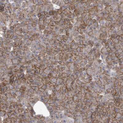 Immunohistochemistry: Apc1 Antibody [NBP2-37880] - Staining of human pancreas shows distinct cytoplasmic positivity in exocrine glandular cells.