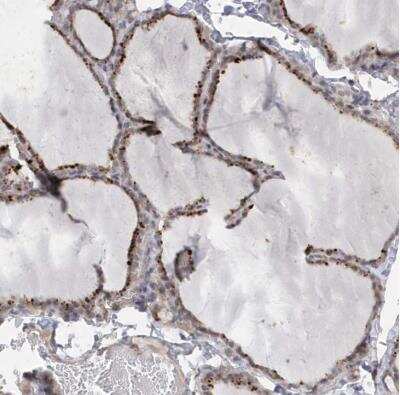 Immunohistochemistry-Paraffin: Apc1 Antibody [NBP1-90141] - Staining of human thyroid gland shows distinct cytoplasmic positivity in glandular cells.