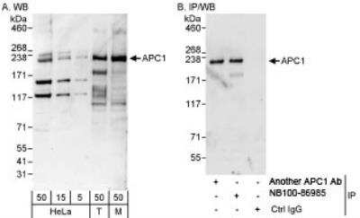 Western Blot: Apc1 Antibody [NB100-86985] - Detection of Human and Mouse APC1 by Western Blot  (h&m) and Immunoprecipitation (h). Samples: Whole cell  lysate from HeLa (5, 15 and 50 mcg for WB; 1 mg for IP, 20% of  IP loaded), 293T (T; 50 mcg), and mouse NIH3T3 (M; 50 mcg)  cells. Antibodies: Affinity purified rabbit anti-APC1 antibody  NB100-86985 used for WB at 0.1 mcg/ml (A) and 1 mcg/ml (B)  and used for IP at 3 mcg/mg lysate. APC1 was also  immunoprecipitated by another rabbit anti-APC1 antibody   which recognizes an upstream epitope.