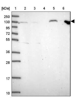 Western Blot: Apc1 Antibody [NBP2-37901] - Lane 1: Marker  [kDa] 250, 130, 95, 72, 55, 36, 28, 17, 10.  Lane 2: Human cell line RT-4.  Lane 3: Human cell line U-251MG.  Lane 4: Human Plasma.  Lane 5: Human liver tissue.  Lane 6: Human tonsil tissue