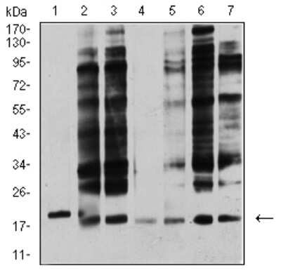 Western Blot: Apc10 Antibody (3E9A9) [NBP2-61888] - Analysis using ANAPC10 mouse mAb against Jurkat (1), MCF-7 (2), SK-Br-3 (3), A431 (4), HEK293 (5), A549 (6), and SPC-A-1 (7) cell lysate.