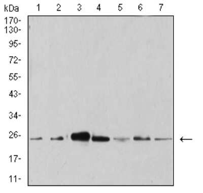 Western Blot: Apc10 Antibody (8F1D10) [NBP2-61889] - Analysis using ANAPC10 mouse mAb against Hela (1), MCF-7 (2), SK-Br-3 (3), A431 (4), HEK293 (5), A549 (6), and SPC-A-1 (7) cell lysate.