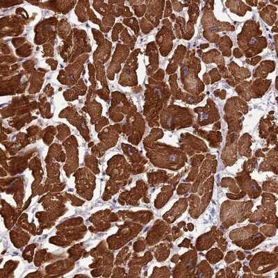 Immunohistochemistry-Paraffin: Apc10 Antibody [NBP2-14291] - Staining of human heart muscle shows strong cytoplasmic positivity in myocytes.