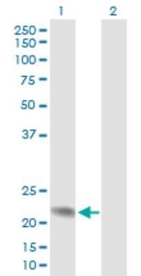 Western Blot: Apc10 Antibody [H00010393-B02P] - Analysis of ANAPC10 expression in transfected 293T cell line by ANAPC10 polyclonal antibody.  Lane 1: ANAPC10 transfected lysate(20.35 KDa). Lane 2: Non-transfected lysate.