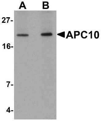 Western Blot: Apc10 Antibody [NBP1-77157] - analysis of APC10 in mouse heart tissue lysate with APC10 antibody at (A) 1 and (B) 2 ug/ml.