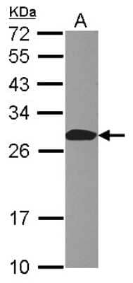 Western Blot: Apc10 Antibody [NBP2-15423] - Sample (30 ug of whole cell lysate) A: MCF-7 12% SDS PAGE; antibody diluted at 1:1000.