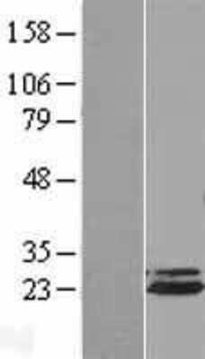 Western Blot Apc10 Overexpression Lysate