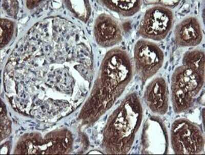 Immunohistochemistry: Apc11 Antibody (OTI3F5) - Azide and BSA Free [NBP2-71939] - Analysis of Human Kidney tissue. (Heat-induced epitope retrieval by 10mM citric buffer, pH6.0, 120C for 3min)