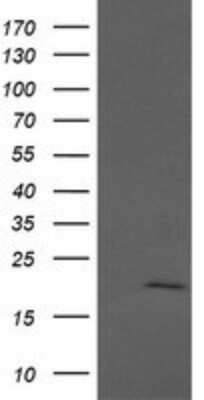 Western Blot: Apc11 Antibody (OTI3F5) - Azide and BSA Free [NBP2-71939] - Analysis of HEK293T cells were transfected with the pCMV6-ENTRY control (Left lane) or pCMV6-ENTRY Apc11.