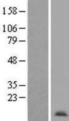 Western Blot: Apc11 Overexpression Lysate (Adult Normal) [NBP2-10733] Left-Empty vector transfected control cell lysate (HEK293 cell lysate); Right -Over-expression Lysate for Apc11.